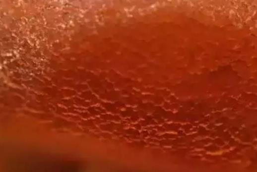 老蜜蜡的鉴别方法：通过蜜蜡表面表皮风化纹路鉴别老蜜蜡,蜜蜡网